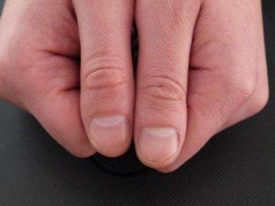 Симптом рака легких: Ученые советуют обратить внимание на состояние пальцев и ногтей