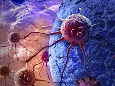 Как раковым опухолям удается скрываться от химиотерапии?