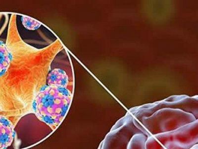 Коронавирус может напрямую поражать клетки кровеносных сосудов мозга, – исследование