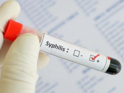Отмечен резкий рост заболеваемости сифилисом в России