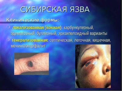 ��������������� ����������� ������� � ������� ����������� ��������� ����� �� �������� ������