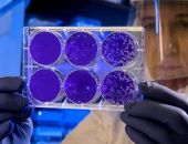 Россиян начнут кормить съедобными бактериями
