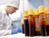 В Феодосии за сутки коронавирусом заболели 47 человек