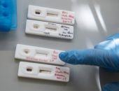 В Крыму начали производить экспресс-тесты на COVID-19