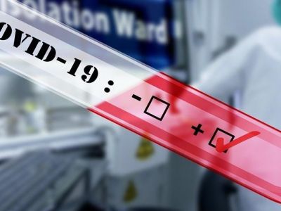 � ������ ���������� ������ ���� ����� ������ �� COVID-19