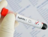 Отмечен резкий рост заболеваемости сифилисом в России
