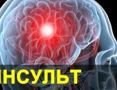 Число инсультов по всему миру растет, ученые бьют тревогу