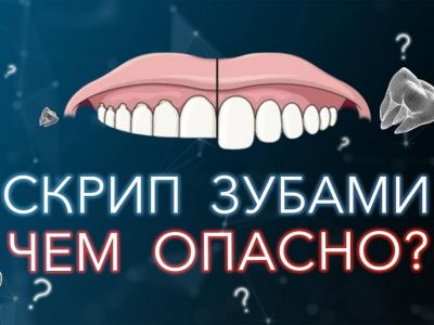 ������ ��������� ������� ������ �� ���?
