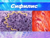 � ����� ����� ������ �������� �������� �������������� ��������� ������� � ��� ����