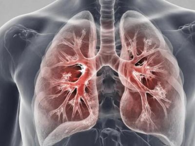 24 ����� - ��������� ���� ������ � ������������ 