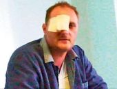 В Кировском районе мужчина выбил глаз соседу В Кировском районе мужчина выбил глаз соседу